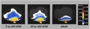 Children's brain tissue impacted by cell phones