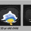 Children's brain tissue impacted by cell phones